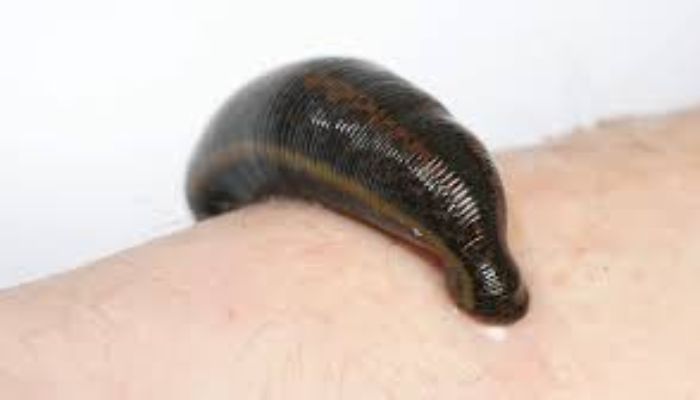 Mơ thấy đỉa cắn